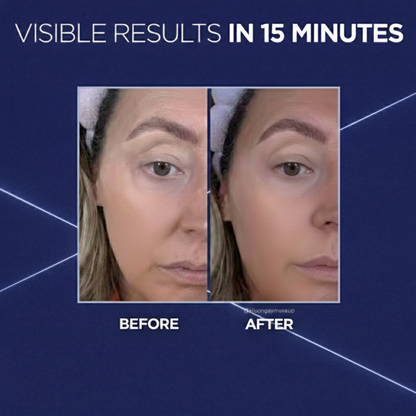 Baseline Lab™ Eye Bag Instant Eraser