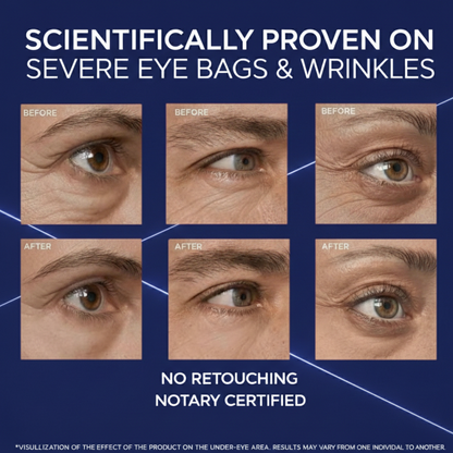 Baseline Lab™ Eye Bag Instant Eraser