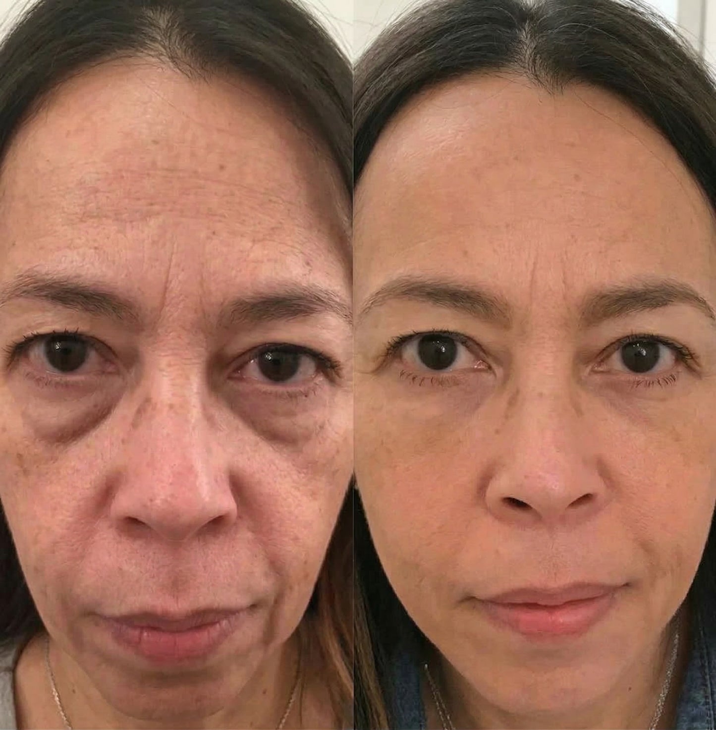 Baseline Lab™ Korean PDRN Eye Patches