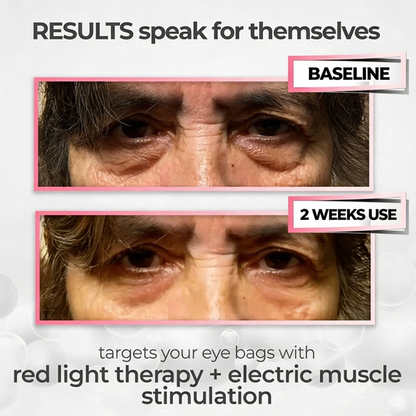 ReviveLens™ 2-in-1 Red Light Therapy + EMS To Erase Eye Bags