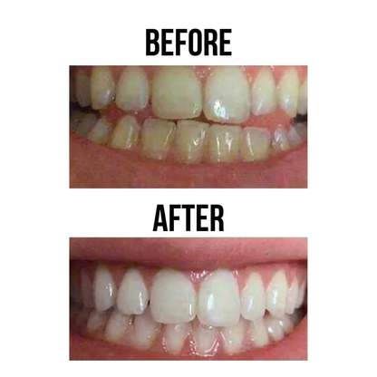 Instant Yellow Tone Remover
