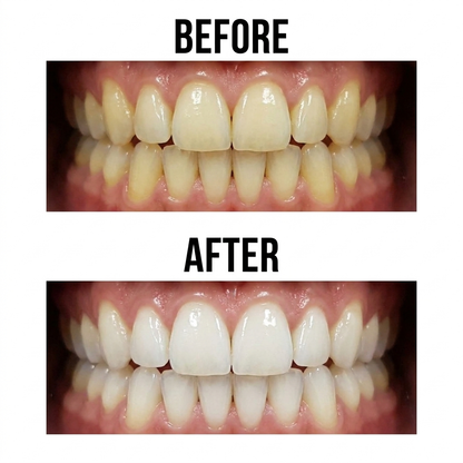 Instant Yellow Tone Remover