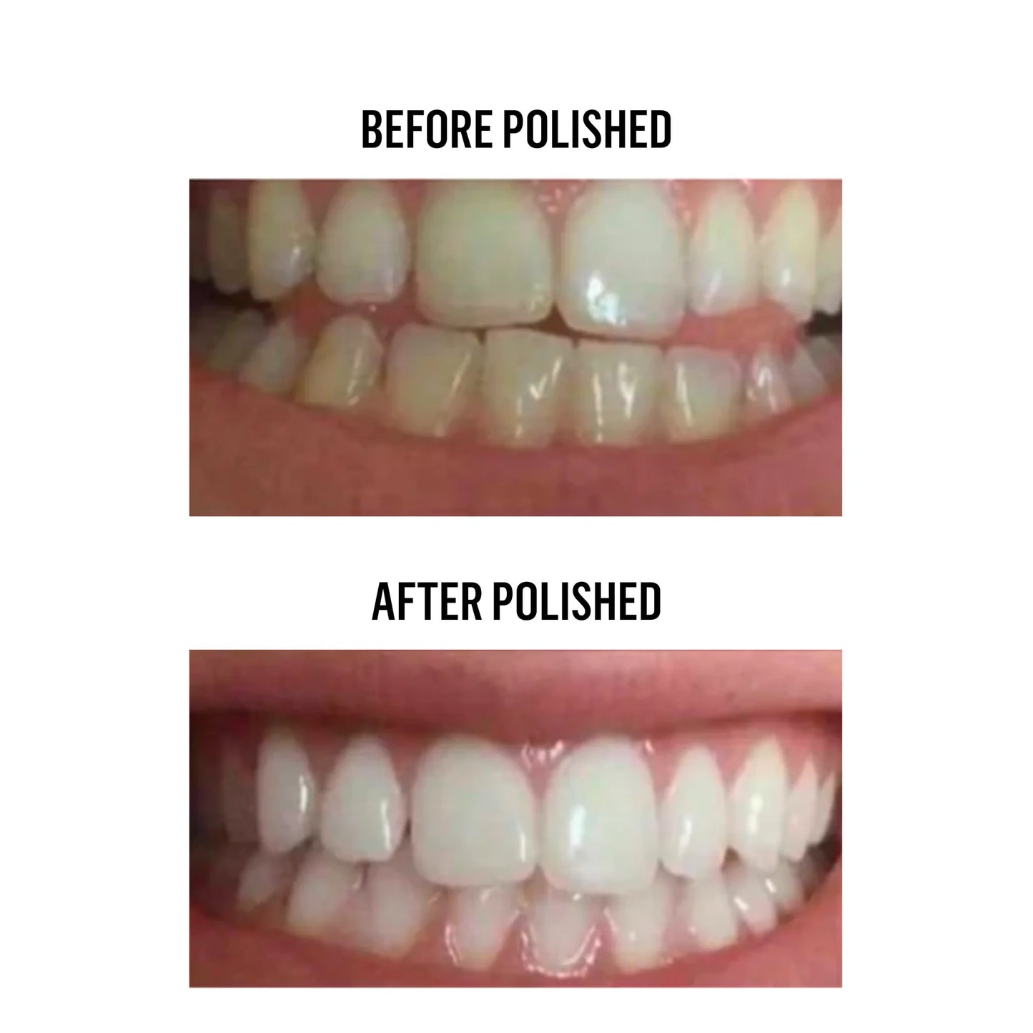 Baseline Lab™ Whitening Powder