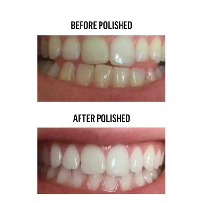 Baseline Lab™ Whitening Powder